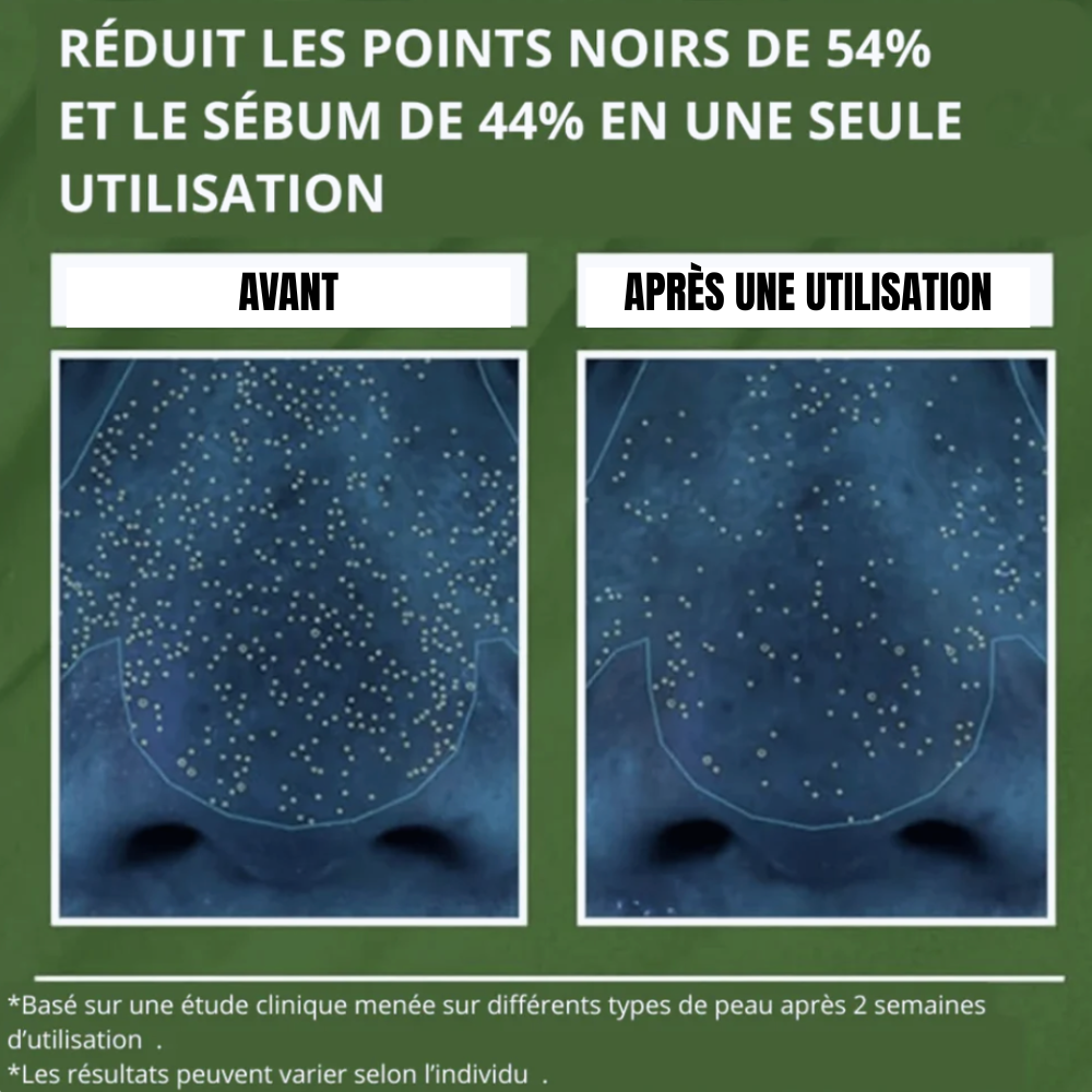 MASQUE BULLES PURIFIANT VELYA